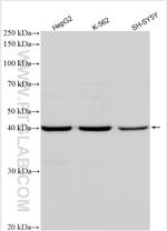 NSUN4 Antibody in Western Blot (WB)
