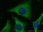 PRSS1 Antibody in Immunocytochemistry (ICC/IF)