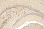 PRSS1 Antibody in Immunohistochemistry (Paraffin) (IHC (P))
