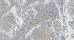 ABCC5 Antibody in Immunohistochemistry (Paraffin) (IHC (P))