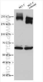 ABCC5 Antibody in Western Blot (WB)