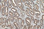 DCLK1 Antibody in Immunohistochemistry (Paraffin) (IHC (P))