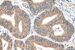 DCLK1 Antibody in Immunohistochemistry (Paraffin) (IHC (P))