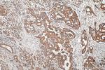 DCLK1 Antibody in Immunohistochemistry (Paraffin) (IHC (P))