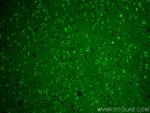 DCLK1 Antibody in Immunohistochemistry (PFA fixed) (IHC (PFA))