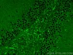 DCLK1 Antibody in Immunohistochemistry (PFA fixed) (IHC (PFA))