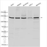 RGS12 Antibody in Western Blot (WB)