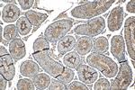 PPP1R13B Antibody in Immunohistochemistry (Paraffin) (IHC (P))