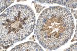 PPP1R13B Antibody in Immunohistochemistry (Paraffin) (IHC (P))