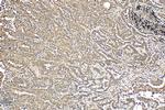 PPP1R13B Antibody in Immunohistochemistry (Paraffin) (IHC (P))