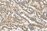 PPP1R13B Antibody in Immunohistochemistry (Paraffin) (IHC (P))