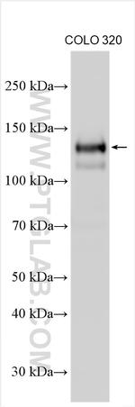 SPINK5 Antibody in Western Blot (WB)