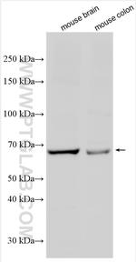 CAPN5 Antibody in Western Blot (WB)