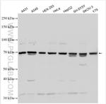 CAPN5 Antibody in Western Blot (WB)