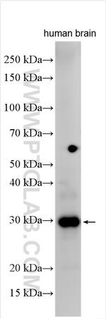 RAB3IP/Rabin8 Antibody in Western Blot (WB)