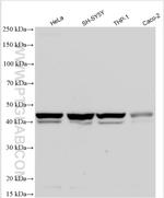 CX3CR1 Antibody in Western Blot (WB)