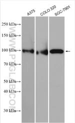 ESCO1 Antibody in Western Blot (WB)