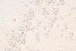 SLC5A8 Antibody in Immunohistochemistry (Paraffin) (IHC (P))