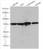SLC5A8 Antibody in Western Blot (WB)