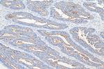 MUC13 Antibody in Immunohistochemistry (Paraffin) (IHC (P))