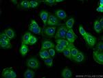 RPS23 Antibody in Immunocytochemistry (ICC/IF)