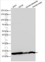 RPS23 Antibody in Western Blot (WB)