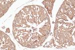 RALGAPA2 Antibody in Immunohistochemistry (Paraffin) (IHC (P))