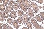 STK24 Antibody in Immunohistochemistry (Paraffin) (IHC (P))