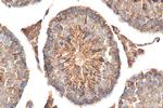 STK24 Antibody in Immunohistochemistry (Paraffin) (IHC (P))