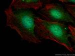 GARNL1 Antibody in Immunocytochemistry (ICC/IF)