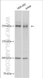 GARNL1 Antibody in Western Blot (WB)