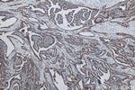 Cytokeratin 19 Antibody in Immunohistochemistry (Paraffin) (IHC (P))