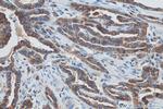 Cytokeratin 19 Antibody in Immunohistochemistry (Paraffin) (IHC (P))