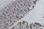 Cytokeratin 19 Antibody in Immunohistochemistry (Paraffin) (IHC (P))