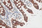 Cytokeratin 19 Antibody in Immunohistochemistry (Paraffin) (IHC (P))