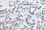 Cytokeratin 19 Antibody in Immunohistochemistry (Paraffin) (IHC (P))