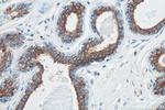Cytokeratin 19 Antibody in Immunohistochemistry (Paraffin) (IHC (P))