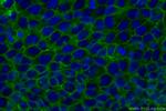 TACSTD2/TROP2 Antibody in Immunocytochemistry (ICC/IF)