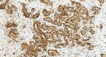 TACSTD2/TROP2 Antibody in Immunohistochemistry (Paraffin) (IHC (P))