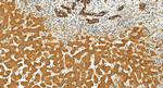 TACSTD2/TROP2 Antibody in Immunohistochemistry (Paraffin) (IHC (P))