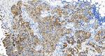 TACSTD2/TROP2 Antibody in Immunohistochemistry (Paraffin) (IHC (P))