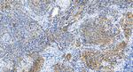 TACSTD2/TROP2 Antibody in Immunohistochemistry (Paraffin) (IHC (P))