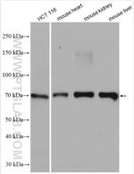 ENT1 Antibody in Western Blot (WB)