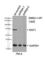 ENT1 Antibody in Western Blot (WB)