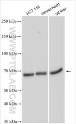 ENT1 Antibody in Western Blot (WB)