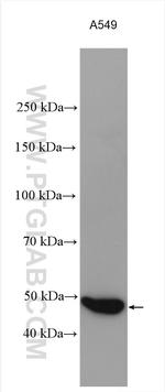 ADRB2 Antibody in Western Blot (WB)