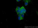 AP2A1 Antibody in Immunocytochemistry (ICC/IF)