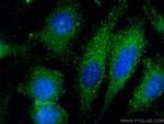 AP2A1 Antibody in Immunocytochemistry (ICC/IF)