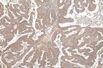 AP2A1 Antibody in Immunohistochemistry (Paraffin) (IHC (P))