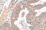 AP2A1 Antibody in Immunohistochemistry (Paraffin) (IHC (P))